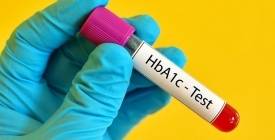Как снизить показатель гликированного гемоглобина (HbA1c). Топ-5 советов