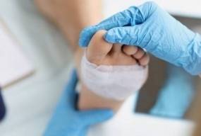 10 міфів та хибних уявлень про діабетичну виразку стопи