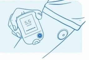 МОЗ розгляне можливість держфінансування сенсорів моніторингу глюкози для пацієнтів з ЦД1 з 2027 року