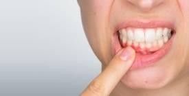 Як діабет впливає на ваші зуби (та ясна)? І що ви можете із цим зробити