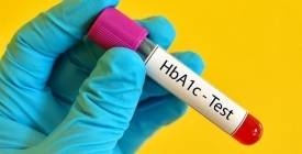 10 способів знизити рівень глікованого гемоглобіну A1C