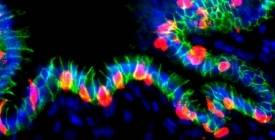 Вчені перетворили клітини шлунка на інсулінові: новий багатообіцяючий метод лікування діабету 1 типу