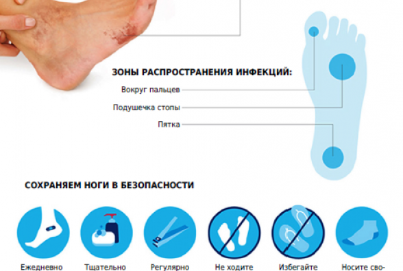 Профилактика диабетической стопы | Журнал Сахарок - все о диабете - Мій ...