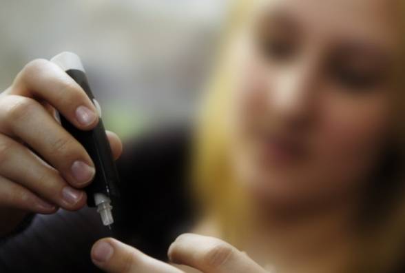 Шотландские исследования могут произвести революцию в лечении диабета 1 типа - изображение