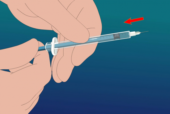 Инъекция инсулина: правила постановки укола наглядно - изображение