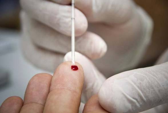 Интересные факты о заборе крови из пальца - изображение