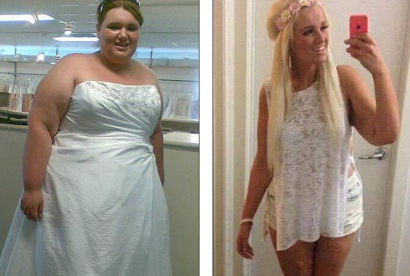 Девушка сбросила почти 100 кг, когда узнала о своем диабете! - изображение