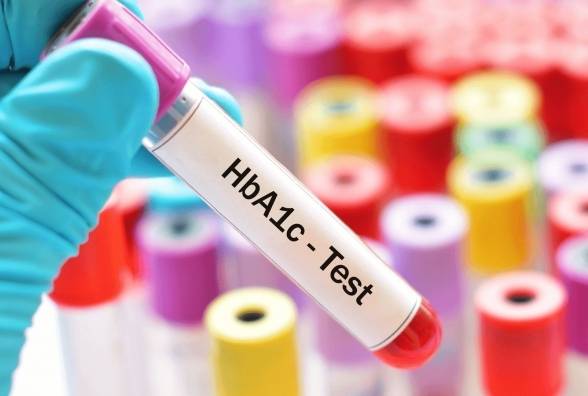 К чему приводит нестабильный уровень HbA1c? Исследование - изображение