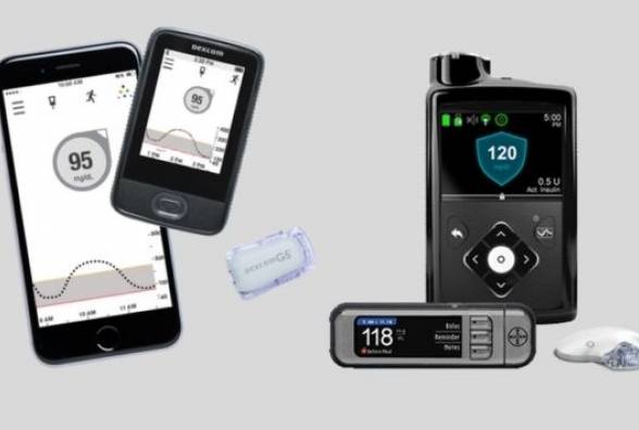 Непрерывный мониторинг глюкозы или инсулиновая помпа: что важнее для хорошей компенсации диабета? - изображение