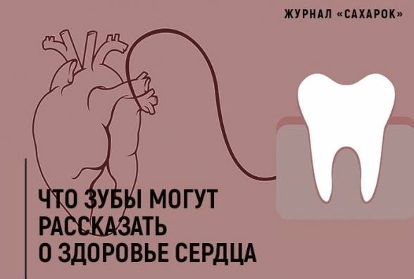 Что зубы могут рассказать о здоровье сердца - изображение