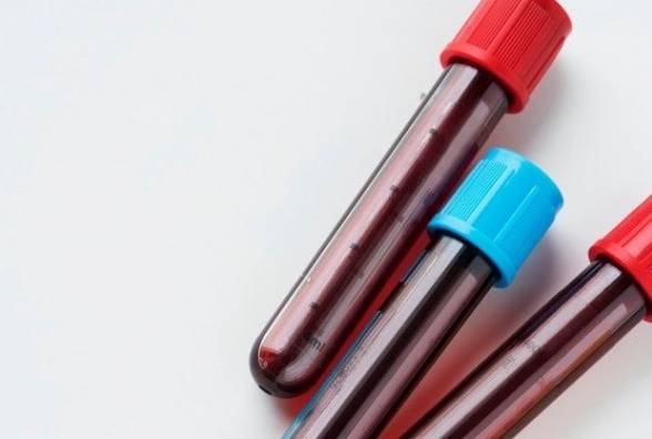 Тести на антитіла до бета-клітин та інсуліну: кому і коли робити, та про що говорять результати? - изображение