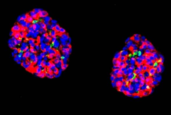 Потенційні ліки від діабету знайшли в клітинах людського шлунку - изображение
