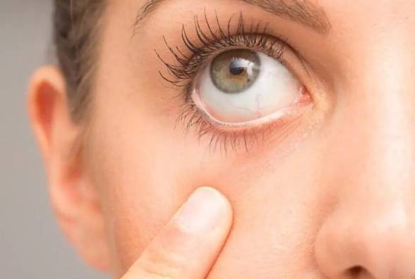 11 ознак, що сигналізують про проблеми з очима при діабеті - изображение