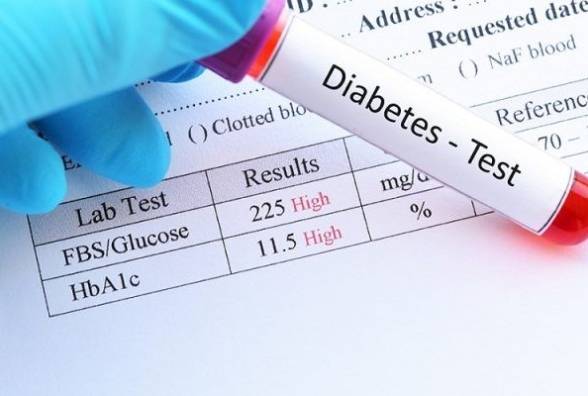 Діабет-чекап: 13 важливих перевірок здоров'я при цукровому діабеті 1-го типу - изображение