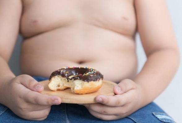 Дитяче ожиріння: симптоми, діагностика та лікування - изображение