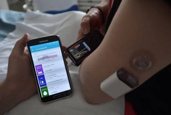 Революція у боротьбі з діабетом 1 типу: тисячі британців отримають «штучну підшлункову залозу» - изображение