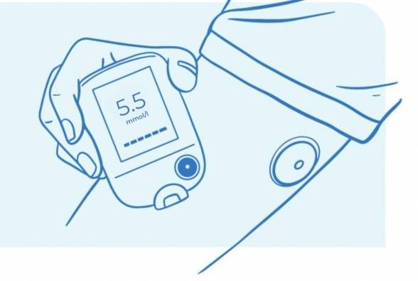 Мода на моніторинг здоров'я: навіщо людині без діабету контролювати рівень цукру в крові за допомогою CGM? - изображение