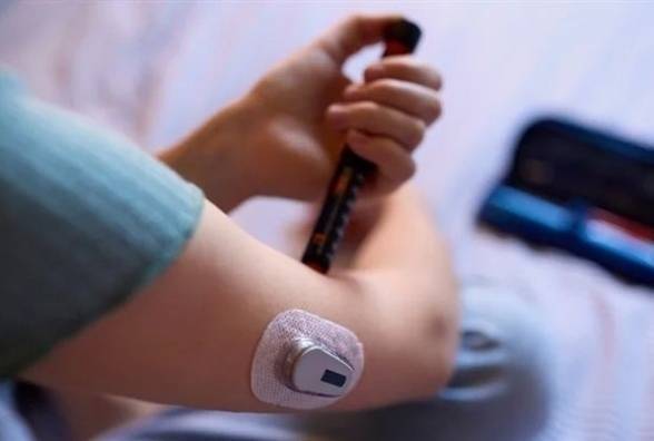 Жінка з діабетом 1-го типу почала виробляти інсулін після трансплантації стовбурових клітин - изображение
