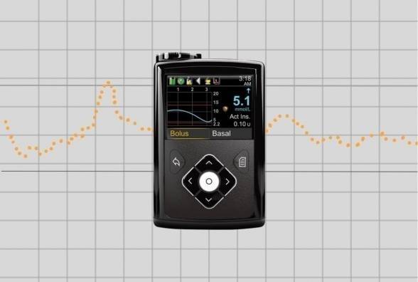 Сотні тисяч інсулінових помп Medtronic відкликано через дефект. Компанія закликає користувачів бути уважними - изображение