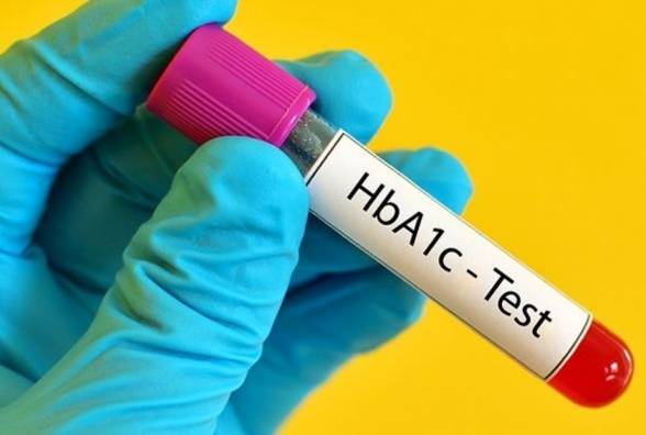 10 способів знизити рівень глікованого гемоглобіну A1C - изображение