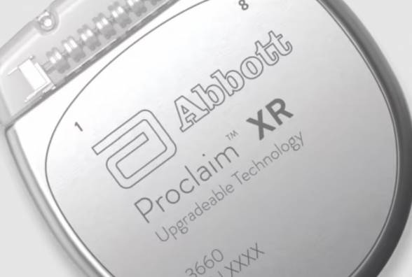 Технології проти болю: як працює імплантат Abbott для лікування діабетичної нейропатії - изображение