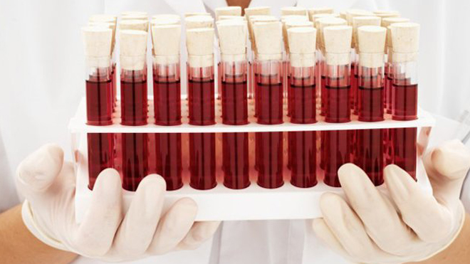 Женщины с третьей группой крови больше всего склонны к диабету 2 типа - 2 фото Женщины с третьей группой крови больше всего склонны к диабету 2 типа - 2 изображение