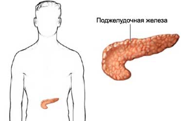 Миссия: вылечить диабет 1 типа - 2 изображение