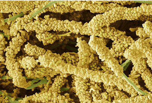 Здоровье ротовой полости при диабете - 4 фото Здоровье ротовой полости при диабете - 4 изображение