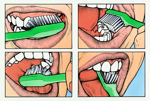 Здоровье ротовой полости при диабете - 5 фото Здоровье ротовой полости при диабете - 5 изображение