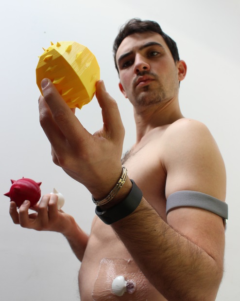 Диабет как искусство. Превращаем уровень сахара в арт-объекты! - 2 изображение