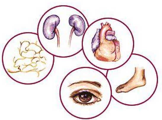 Вероятность развития осложнений диабета 1 и 2 типа - 2 изображение