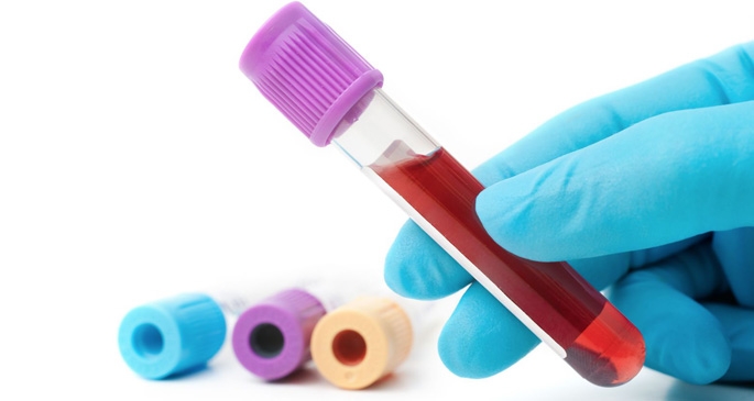 5 способов снижения уровня гликированного гемоглобина - берем на заметку - 4 изображение