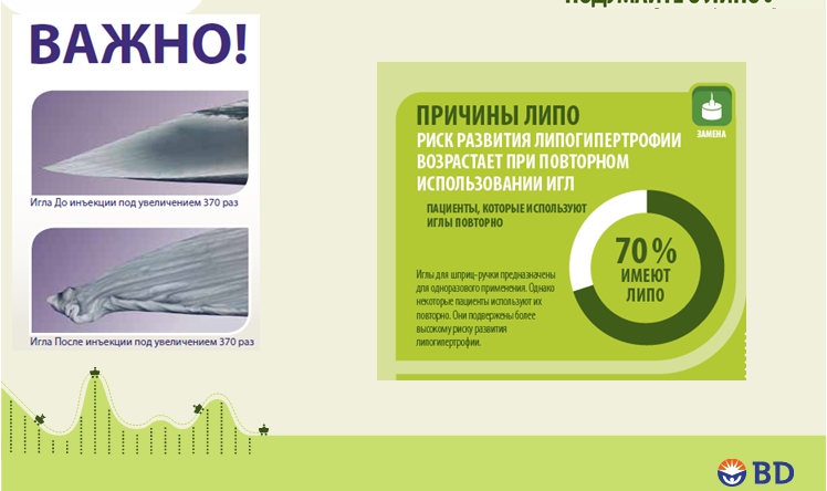 Липогипертрофия при диабете: инфографика, данные исследований. ПРЕЗЕНТАЦИЯ - 15 изображение