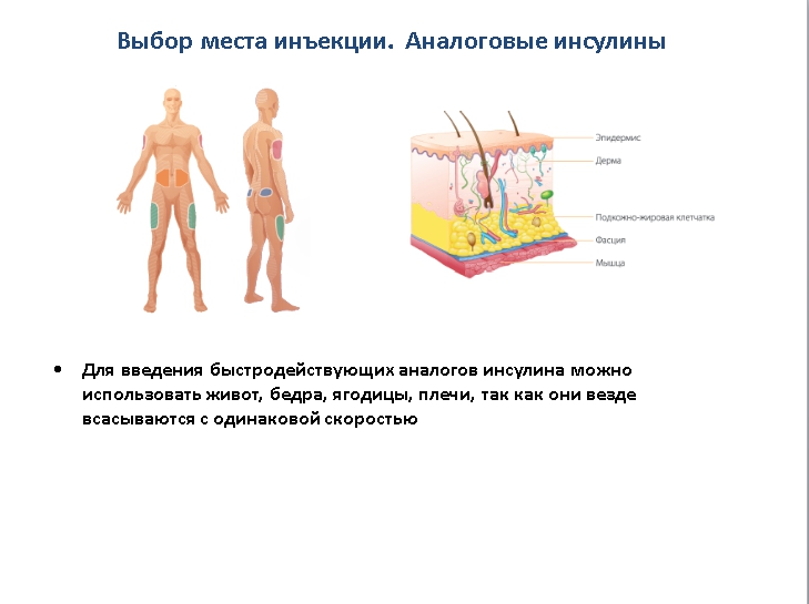 Инсулин и способы его введения: обучающая презентация для детей от Junior DiabEduc - 14 изображение