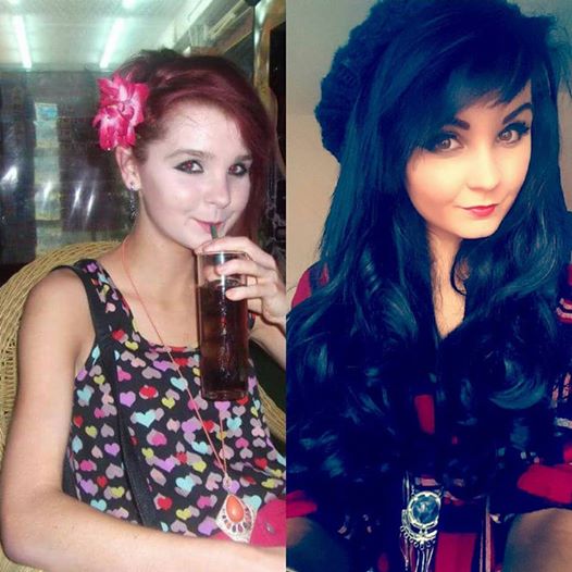 Почти треть женщин с СД1 страдают от этого скрытого расстройства - 2 изображение