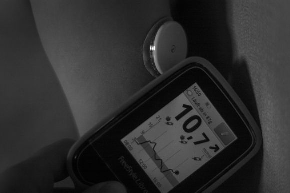 Будни диабетика или 365 дней в году - ФОТОСЕССИЯ - 6 фото Будни диабетика или 365 дней в году - ФОТОСЕССИЯ - 6 изображение