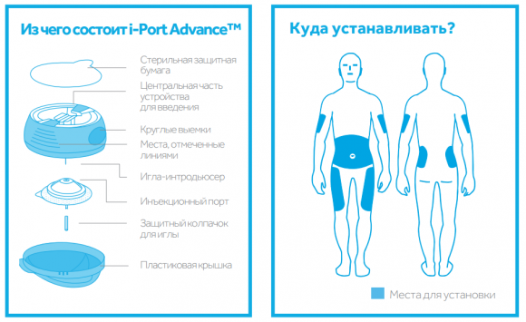 I-port Advance уже в Украине! Обзор, цены, контакты - 4 фото I-port Advance уже в Украине! Обзор, цены, контакты - 4 изображение