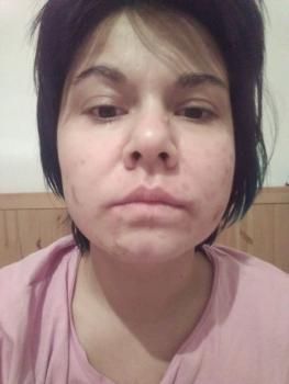 Применение крема Diabetegen при диабете: отчет 4 - 2 фото Применение крема Diabetegen при диабете: отчет 4 - 2 изображение