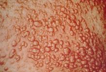 12 признаков проблем с сердцем - проверьте свои риски - 2 изображение