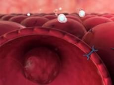 Инсулинома - редкая опухоль, секретирующая инсулин. Диагностирование и способы лечения - 3 изображение