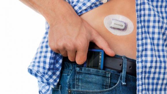 Dexcom G5 оказался лучше FreeStyle Libre в борьбе с гипогликемией: исследование - 3 фото Dexcom G5 оказался лучше FreeStyle Libre в борьбе с гипогликемией: исследование - 3 изображение