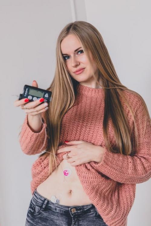 ФОТОпроект ``Красивый диабет`` - 9 фото ФОТОпроект ``Красивый диабет`` - 9 изображение