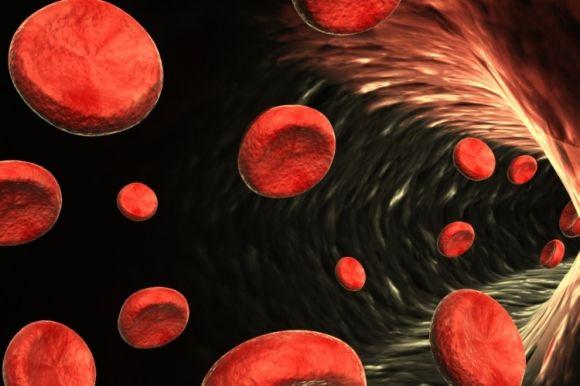 С чего начинается атеросклероз - 2 фото С чего начинается атеросклероз - 2 изображение