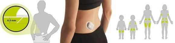 Omnipod DASH. Особенности новой беспроводной инсулиновой помпы - 3 изображение