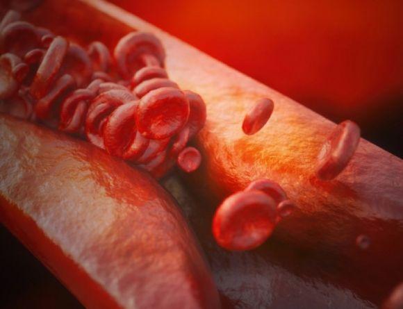 Атеросклероз. Можно ли обернуть процесс образования бляшек в сосудах? - 2 фото Атеросклероз. Можно ли обернуть процесс образования бляшек в сосудах? - 2 изображение