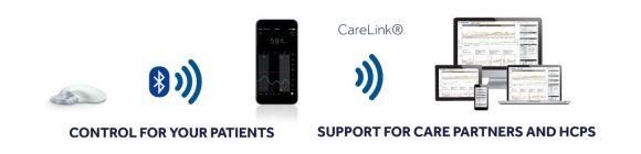 Guardian Connect — обзор системы постоянного мониторинга глюкозы компании Medtronic - 2 изображение