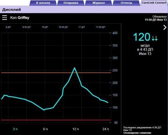 Guardian Connect — обзор системы постоянного мониторинга глюкозы компании Medtronic - 3 изображение
