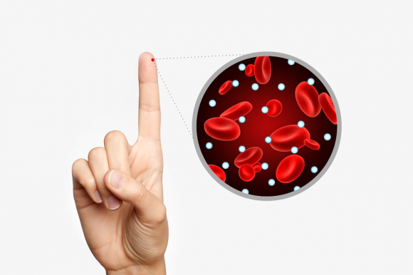 Высокий инсулин и инсулинорезистентность - 2 фото Высокий инсулин и инсулинорезистентность - 2 изображение