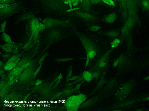 Инновации в лечении диабета. Мезенхимальные стволовые клетки - 3 фото Инновации в лечении диабета. Мезенхимальные стволовые клетки - 3 изображение