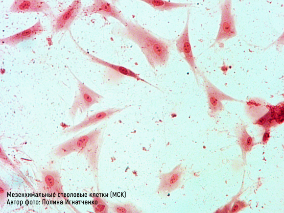 Инновации в лечении диабета. Мезенхимальные стволовые клетки - 2 фото Инновации в лечении диабета. Мезенхимальные стволовые клетки - 2 изображение